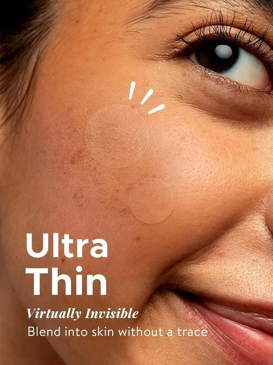 360-Pack Hydrocolloid Pimple Patches – Invisible, Waterproof & Ultra-Thin Daytime Cover