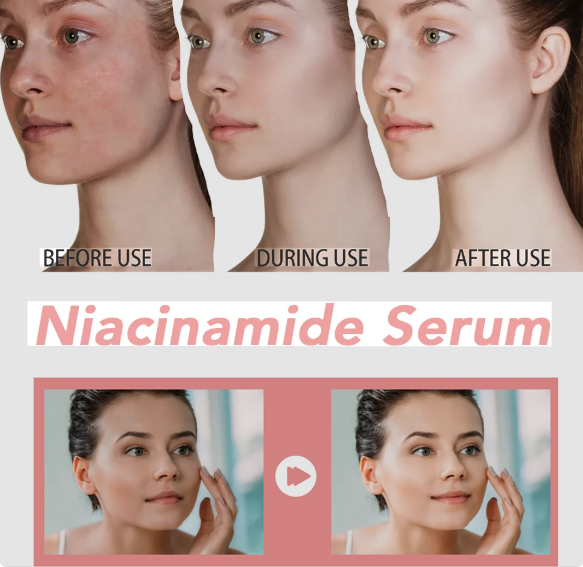 Peach 70 Niacinamide Serum