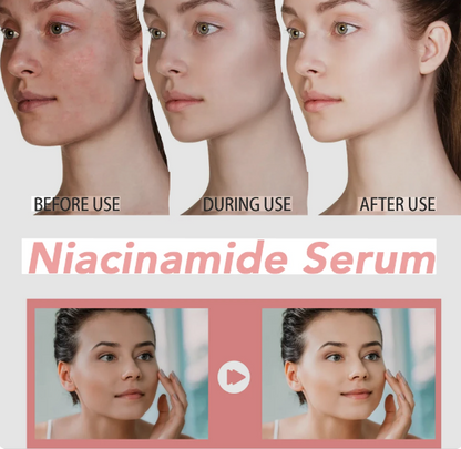 Peach 70 Niacinamide Serum